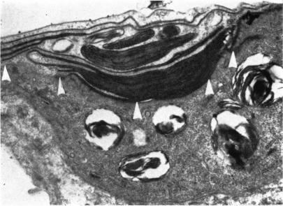 https://cdn.ncbi.nlm.nih.gov/pmc/blobs/c5af/1271406/5e3eca4d26a5/janat00319-0032-a.jpg