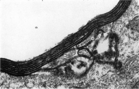 https://cdn.ncbi.nlm.nih.gov/pmc/blobs/c5af/1271406/b5f9cd7d06b6/janat00319-0029-a.jpg