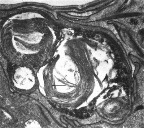 https://cdn.ncbi.nlm.nih.gov/pmc/blobs/c5af/1271406/d578af4252ce/janat00319-0034-a.jpg
