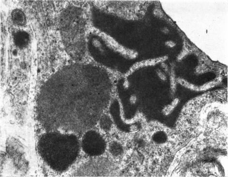 https://cdn.ncbi.nlm.nih.gov/pmc/blobs/c5af/1271406/eda33cb8e675/janat00319-0036-a.jpg
