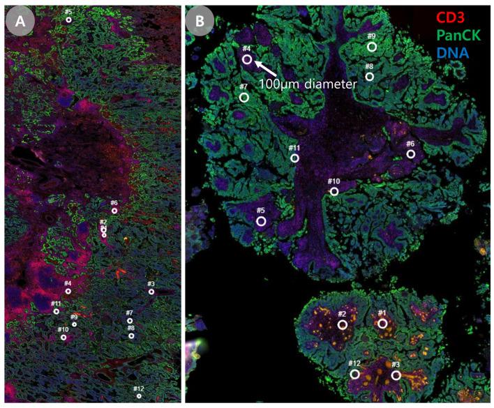 https://cdn.ncbi.nlm.nih.gov/pmc/blobs/c5b1/12345659/62fec53b2f06/cancers-17-02529-g001.jpg