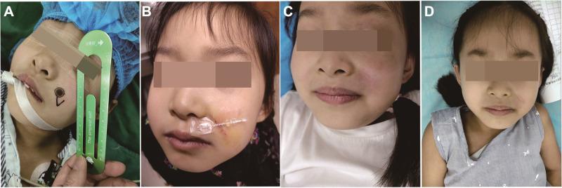 https://cdn.ncbi.nlm.nih.gov/pmc/blobs/c5b3/8881920/f10d90ed6ddf/CCID-15-283-g0002.jpg