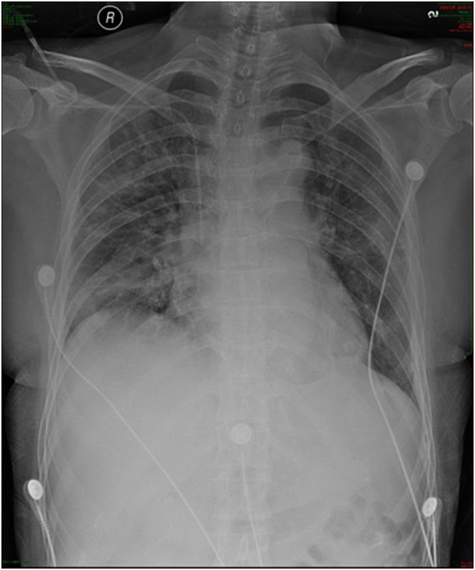 https://cdn.ncbi.nlm.nih.gov/pmc/blobs/c5b6/7282787/23a6053375c0/gr1_lrg.jpg