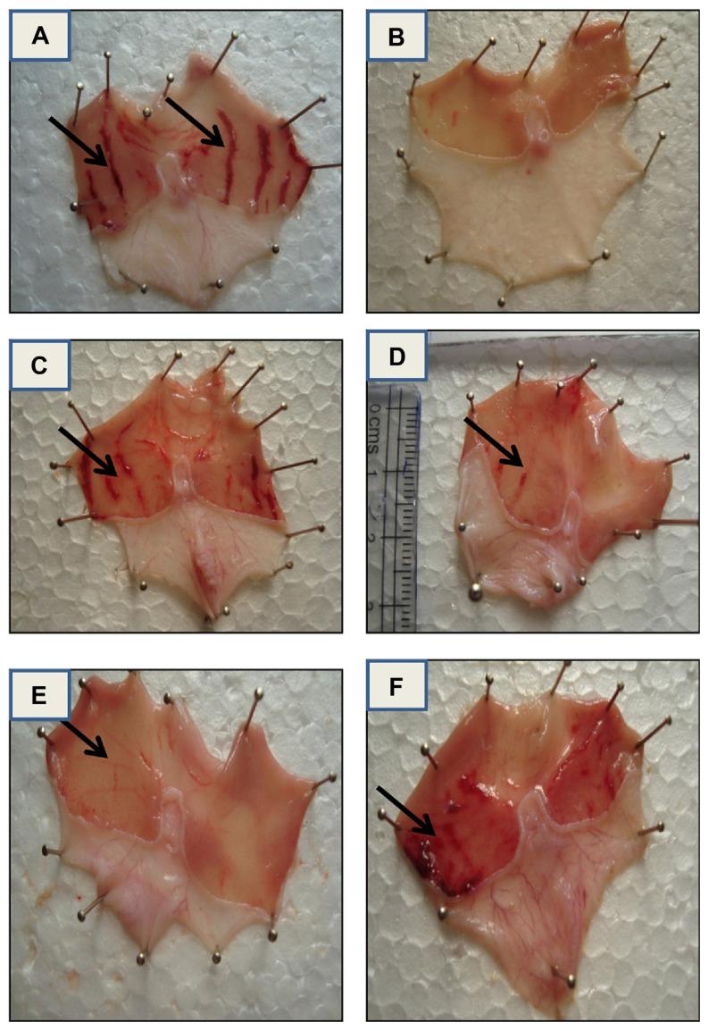 https://cdn.ncbi.nlm.nih.gov/pmc/blobs/c5b6/9351796/9aad8e7de480/jfda-23-03-376f2.jpg