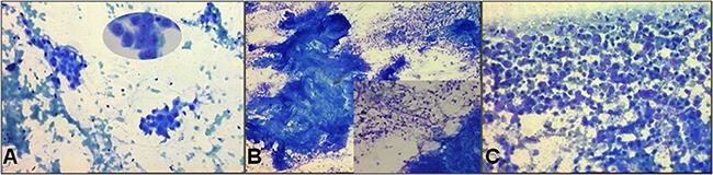 https://cdn.ncbi.nlm.nih.gov/pmc/blobs/c5b7/5355257/b00fbb4fb35a/oncotarget-08-11199-g002.jpg