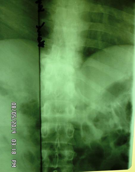 https://cdn.ncbi.nlm.nih.gov/pmc/blobs/c5b9/5511723/f4201457d8db/PAMJ-27-2-g002.jpg