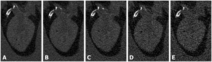 https://cdn.ncbi.nlm.nih.gov/pmc/blobs/c5c0/5453409/131f3f6ae564/10.1177_2058460117710682-fig4.jpg