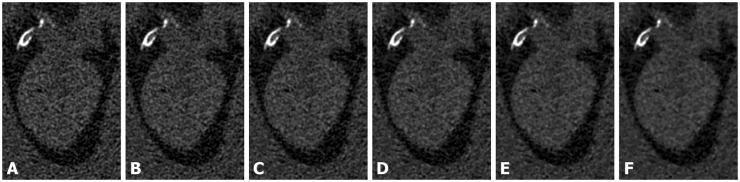 https://cdn.ncbi.nlm.nih.gov/pmc/blobs/c5c0/5453409/29c7cf331baa/10.1177_2058460117710682-fig5.jpg