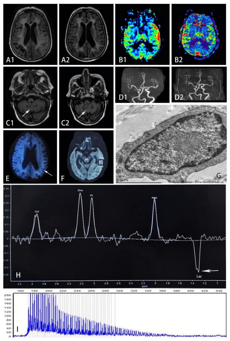 https://cdn.ncbi.nlm.nih.gov/pmc/blobs/c5c8/9599545/f807fba94d11/brainsci-12-01377-g002.jpg