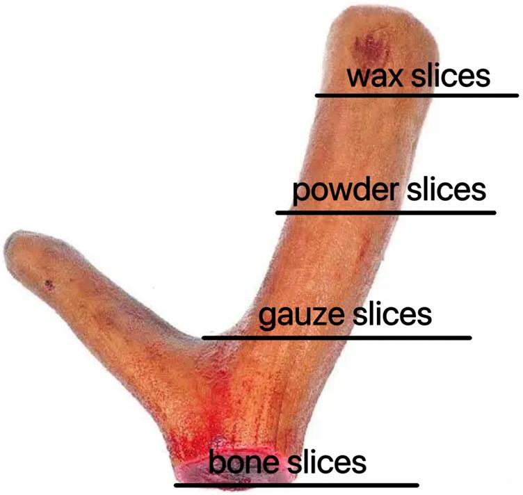 https://cdn.ncbi.nlm.nih.gov/pmc/blobs/c5cc/11693646/b2685500d774/fphar-15-1468237-g001.jpg