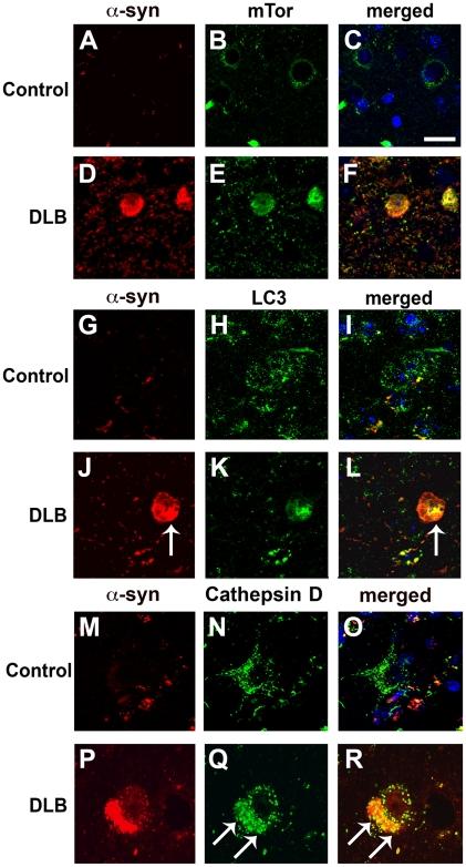 https://cdn.ncbi.nlm.nih.gov/pmc/blobs/c5ce/2824828/0813e830770e/pone.0009313.g003.jpg