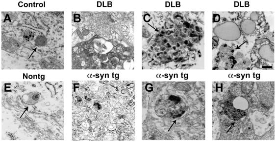 https://cdn.ncbi.nlm.nih.gov/pmc/blobs/c5ce/2824828/465e4c21e548/pone.0009313.g004.jpg