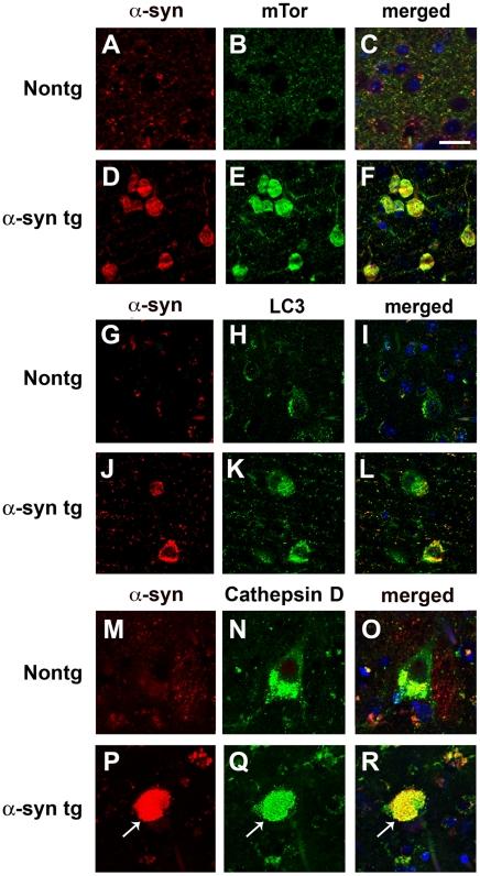 https://cdn.ncbi.nlm.nih.gov/pmc/blobs/c5ce/2824828/4cc721153fc0/pone.0009313.g007.jpg
