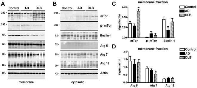 https://cdn.ncbi.nlm.nih.gov/pmc/blobs/c5ce/2824828/b7ffe8887ced/pone.0009313.g001.jpg