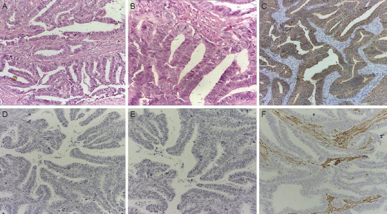 https://cdn.ncbi.nlm.nih.gov/pmc/blobs/c5d1/11424185/1e805f9f4896/ogs-24120f2.jpg