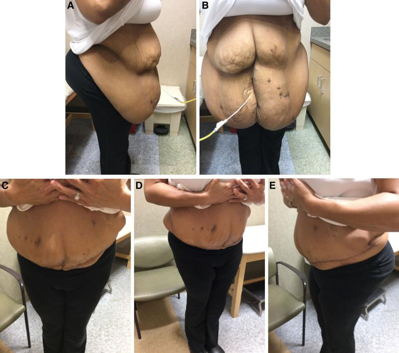 https://cdn.ncbi.nlm.nih.gov/pmc/blobs/c5d1/11671086/7c3515565341/gox-12-e6381-g002.jpg