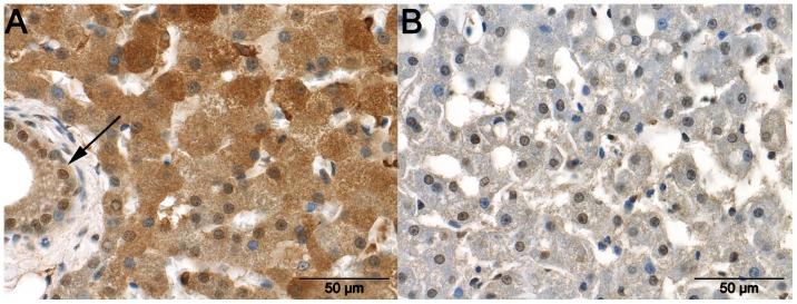 https://cdn.ncbi.nlm.nih.gov/pmc/blobs/c5d3/3581512/184521e45dc4/pone.0057662.g004.jpg