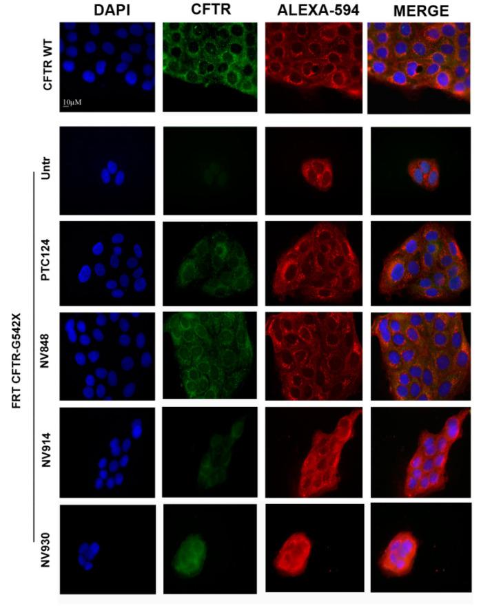 https://cdn.ncbi.nlm.nih.gov/pmc/blobs/c5d9/7504161/9e39527038df/ijms-21-06420-g006.jpg