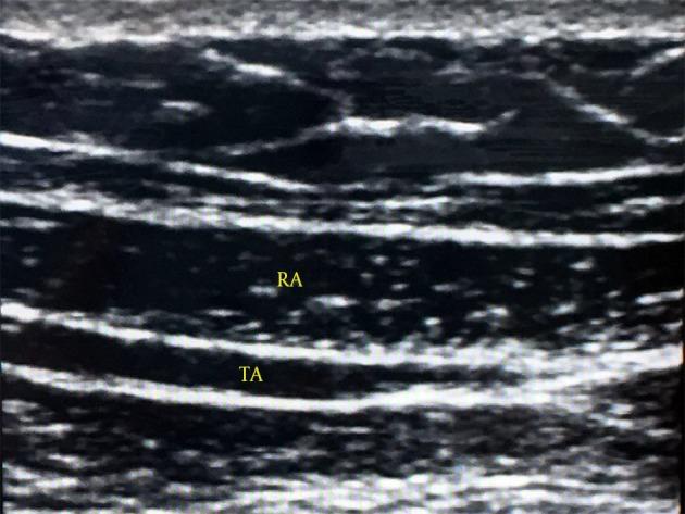 https://cdn.ncbi.nlm.nih.gov/pmc/blobs/c5e9/5903215/1acf095df310/aapm-07-05-12923-g003.jpg