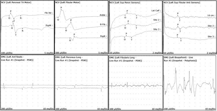 https://cdn.ncbi.nlm.nih.gov/pmc/blobs/c5e9/8110298/95435c042508/cureus-0013-00000014374-i01.jpg