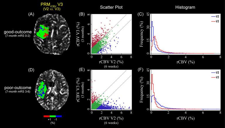 https://cdn.ncbi.nlm.nih.gov/pmc/blobs/c5ec/10248057/22daae7f009e/fnins-17-1177044-g004.jpg