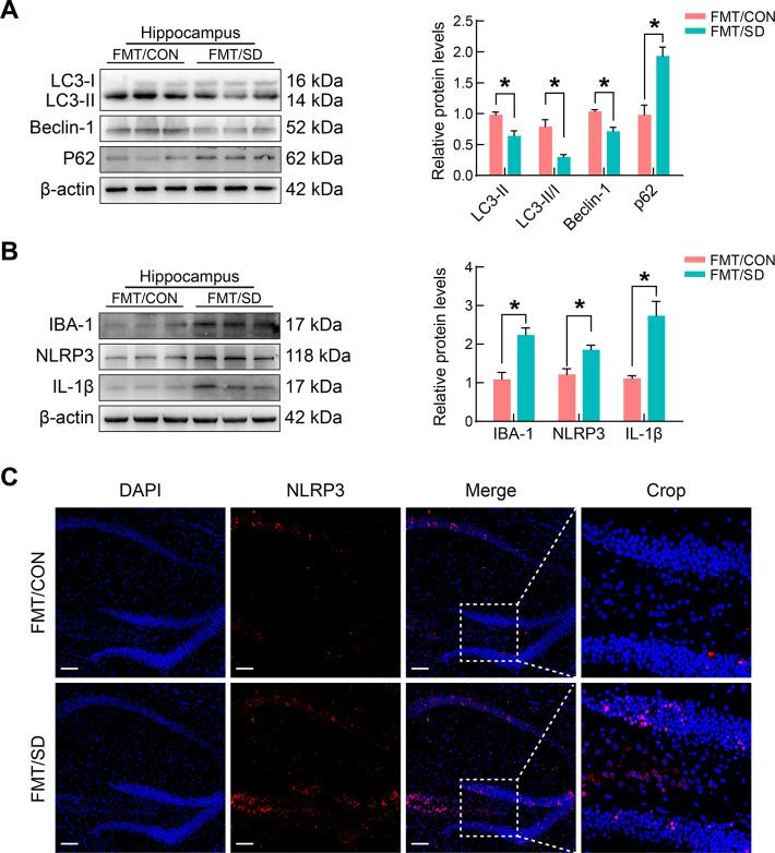 https://cdn.ncbi.nlm.nih.gov/pmc/blobs/c5f3/11298670/4cef55bb8ac1/zr-45-4-857-5.jpg
