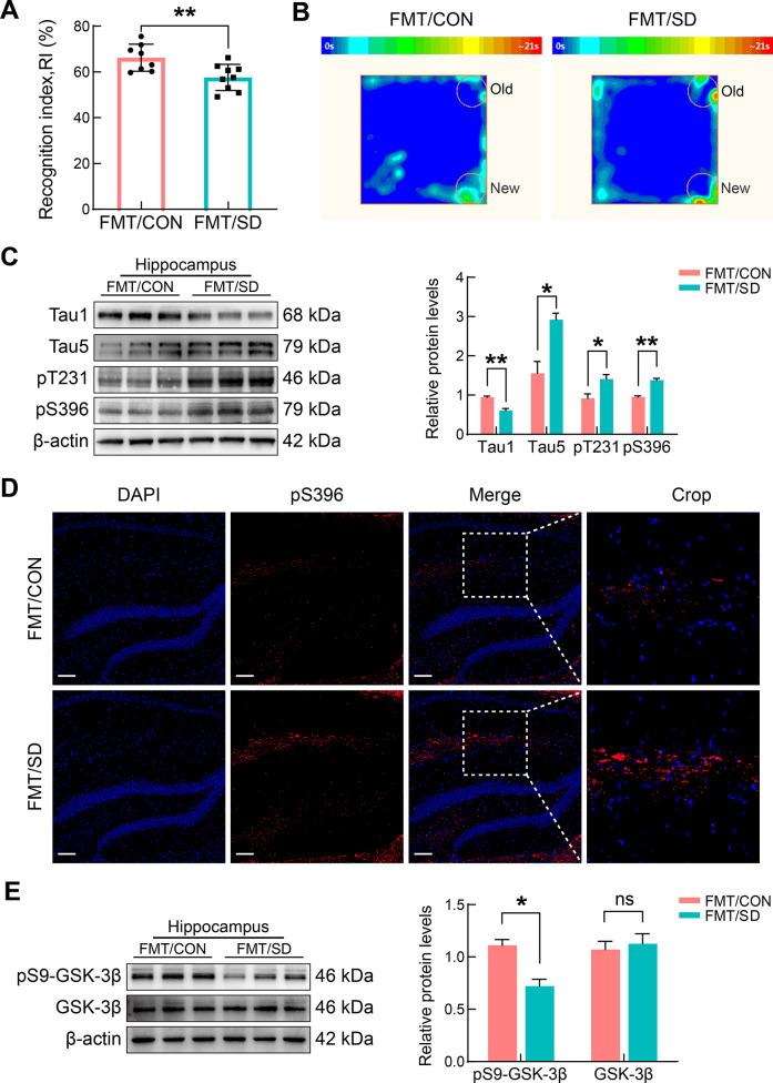 https://cdn.ncbi.nlm.nih.gov/pmc/blobs/c5f3/11298670/8d7b6479cf44/zr-45-4-857-4.jpg