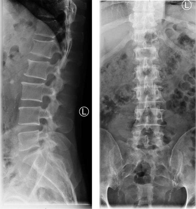 https://cdn.ncbi.nlm.nih.gov/pmc/blobs/c5f3/11599295/4230eeb2618a/68_2024_2619_Fig8_HTML.jpg