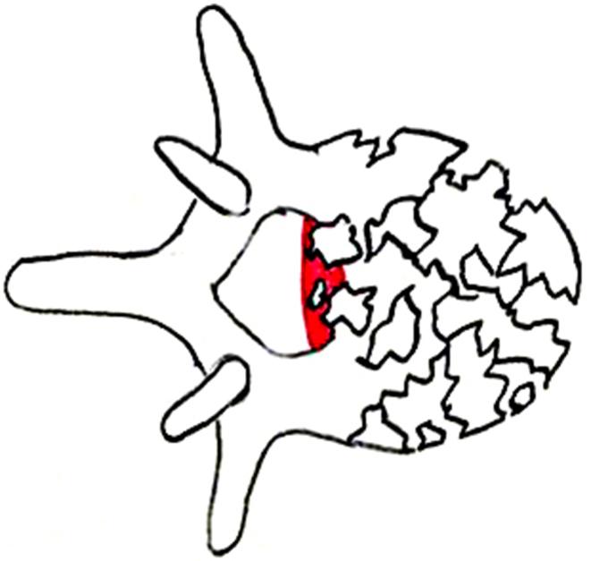 https://cdn.ncbi.nlm.nih.gov/pmc/blobs/c5f3/11599295/fd3dad61f232/68_2024_2619_Fig4_HTML.jpg