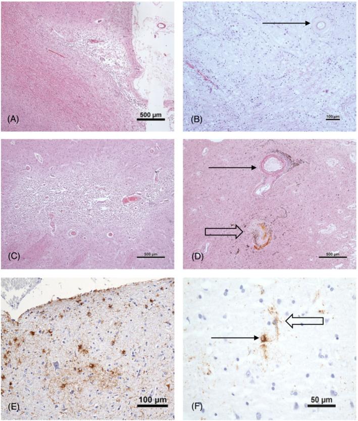 https://cdn.ncbi.nlm.nih.gov/pmc/blobs/c5f4/10946587/4262e33263c2/NAN-49-0-g002.jpg