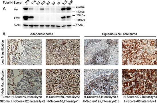 https://cdn.ncbi.nlm.nih.gov/pmc/blobs/c5fc/4496212/97e8fe57a80a/oncotarget-06-9206-g002.jpg