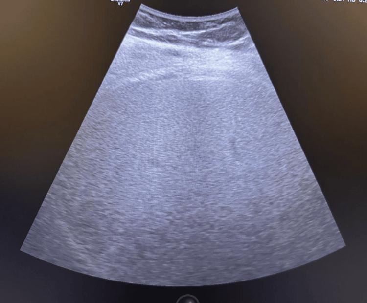 https://cdn.ncbi.nlm.nih.gov/pmc/blobs/c601/12326341/c6fcaac035c8/cureus-0017-00000087416-i01.jpg