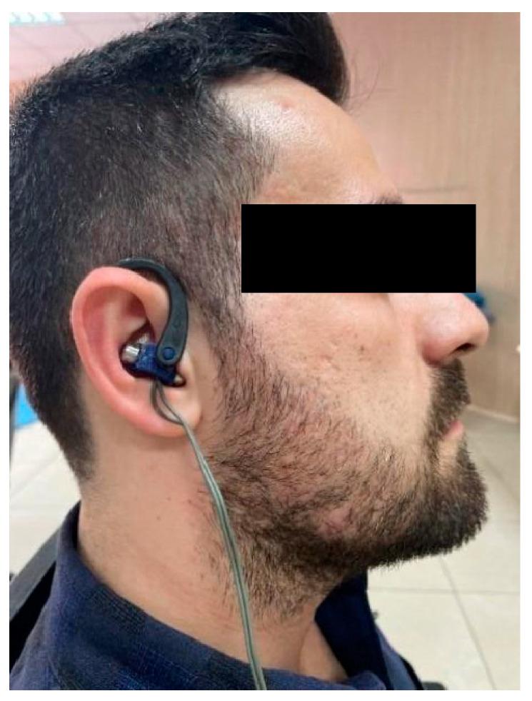 https://cdn.ncbi.nlm.nih.gov/pmc/blobs/c609/11856507/993b52c502b1/jcm-14-01046-g001.jpg
