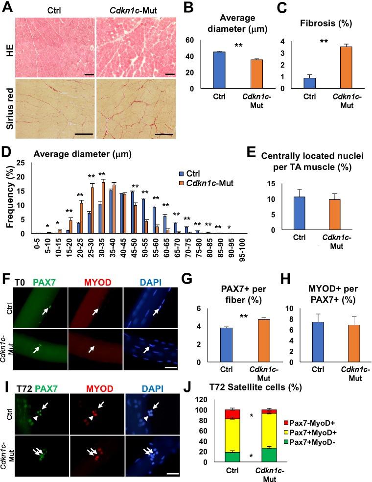 https://cdn.ncbi.nlm.nih.gov/pmc/blobs/c609/6172026/736ae6d8e53d/elife-33337-fig1.jpg