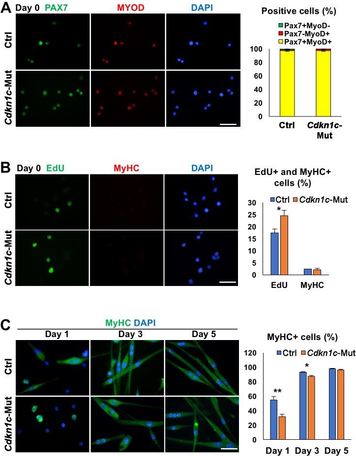 https://cdn.ncbi.nlm.nih.gov/pmc/blobs/c609/6172026/a8c01b7b2b6b/elife-33337-fig3-figsupp2.jpg