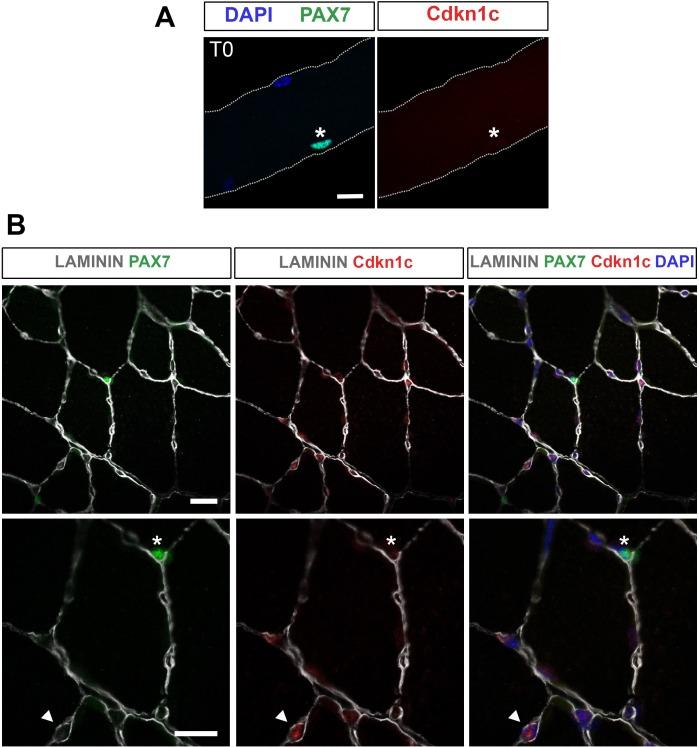 https://cdn.ncbi.nlm.nih.gov/pmc/blobs/c609/6172026/ee07013a6366/elife-33337-fig5-figsupp1.jpg