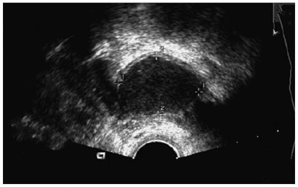 https://cdn.ncbi.nlm.nih.gov/pmc/blobs/c60a/5639417/ecd245f0c319/etm-14-04-3749-g03.jpg