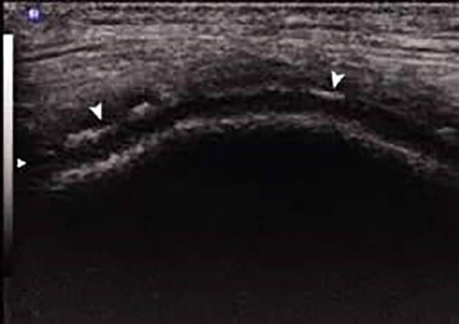 https://cdn.ncbi.nlm.nih.gov/pmc/blobs/c60c/11058609/e72db4df3929/393_2024_1482_Fig3_HTML.jpg