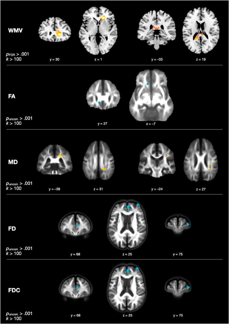 https://cdn.ncbi.nlm.nih.gov/pmc/blobs/c60c/12172729/484868e8d4d6/gr1.jpg