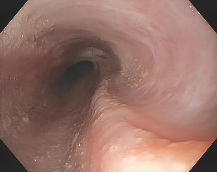 https://cdn.ncbi.nlm.nih.gov/pmc/blobs/c611/11168795/d8c5c90c5712/10-1055-a-2325-2770_23258487.jpg