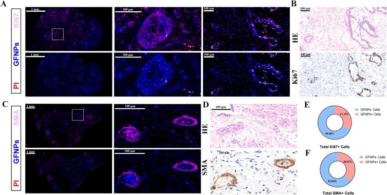 https://cdn.ncbi.nlm.nih.gov/pmc/blobs/c611/11386073/d6bc40164ad4/IJN-19-9121-g0009.jpg