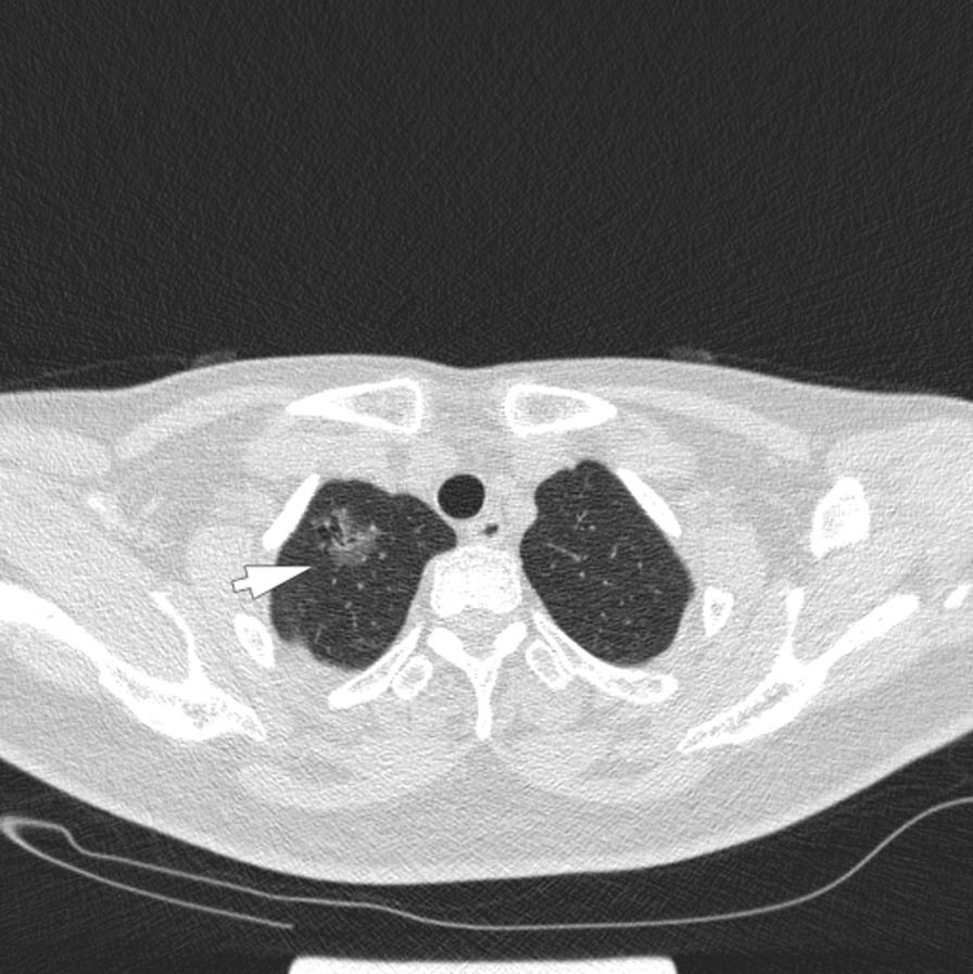 https://cdn.ncbi.nlm.nih.gov/pmc/blobs/c611/9361596/8eb916950218/12879_2022_7591_Fig1_HTML.jpg