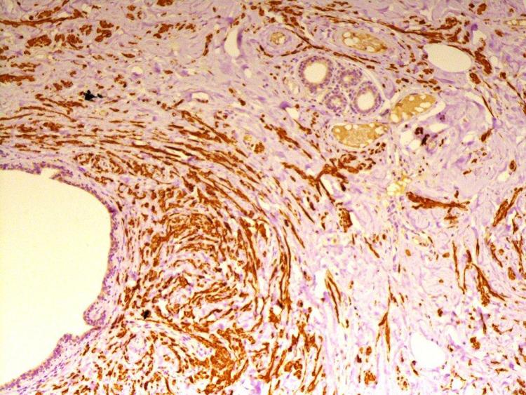 https://cdn.ncbi.nlm.nih.gov/pmc/blobs/c617/4802348/3cd5a1972b98/gr2.jpg