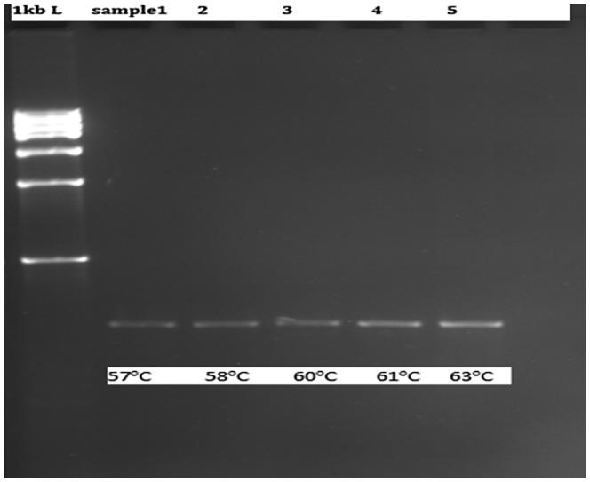 https://cdn.ncbi.nlm.nih.gov/pmc/blobs/c61b/9034683/42419a993b2f/MGG3-10-e1930-g001.jpg