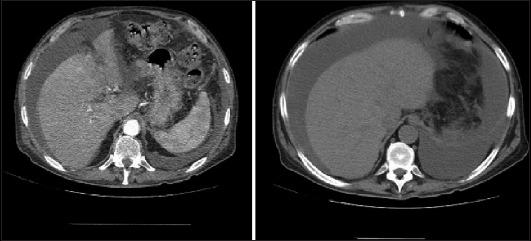 https://cdn.ncbi.nlm.nih.gov/pmc/blobs/c624/12070342/38bb28fff92b/AnnGastroenterol-38-247-g001.jpg
