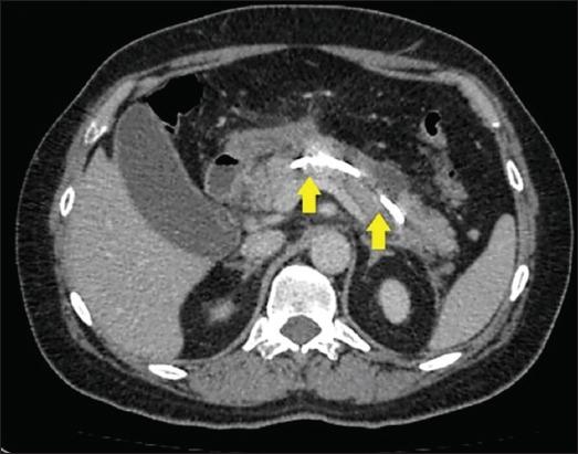 https://cdn.ncbi.nlm.nih.gov/pmc/blobs/c624/12070342/5cbabe833406/AnnGastroenterol-38-247-g004.jpg