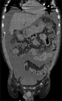 https://cdn.ncbi.nlm.nih.gov/pmc/blobs/c624/12070342/ea56e35a489f/AnnGastroenterol-38-247-g002.jpg