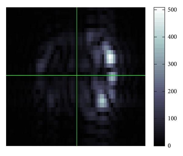 https://cdn.ncbi.nlm.nih.gov/pmc/blobs/c624/3638697/d19f83d235c2/CMMM2013-912920.020.jpg