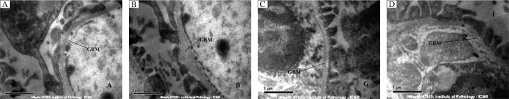 https://cdn.ncbi.nlm.nih.gov/pmc/blobs/c625/3596720/b683c90df062/jbr-25-06-411-g002.jpg