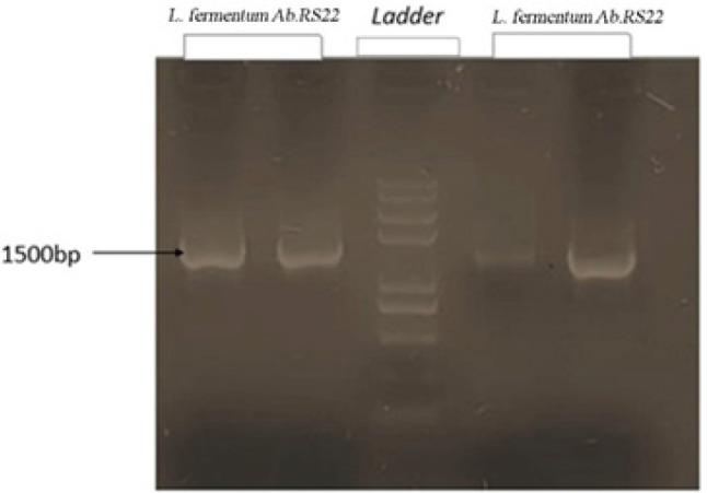 https://cdn.ncbi.nlm.nih.gov/pmc/blobs/c626/10897561/f8583ecca26c/IJBMS-27-447-g001.jpg